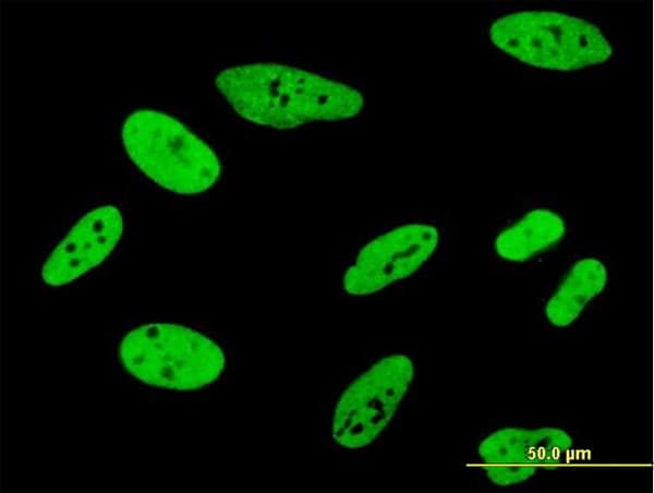 FUBP1 Antibody (clone 3H4)
