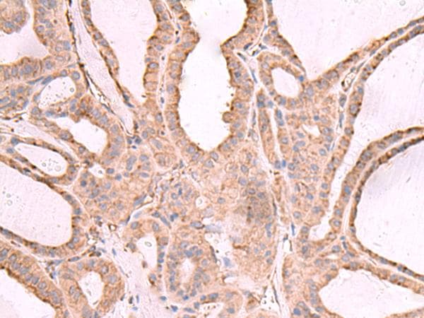 Polyclonal Rabbit anti-Human EEF1D Antibody (IHC, WB)