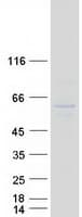 Human ING3 Protein (Recombinant Myc-DDK (Flag))