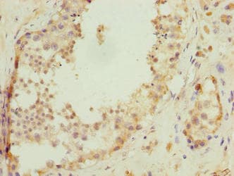 Polyclonal Rabbit anti-Human C17orf47 Antibody (IHC)