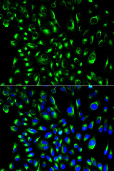 Polyclonal Rabbit anti-Human LCP2 / SLP-76 Antibody (IHC, IF, WB)