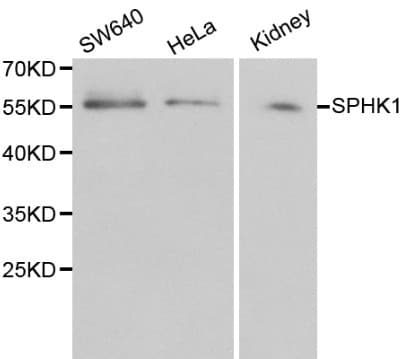 SPHK / SPHK1 Antibody