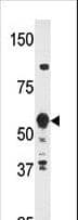 IHC-plus™ ZNF395 Antibody (aa141-170)