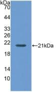MGAM / Maltase-Glucoamylase Antibody (aa213-392, PE)