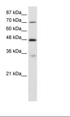 Polyclonal Rabbit anti-Human CARS1 / CARS Antibody (aa661-710, IHC, WB)