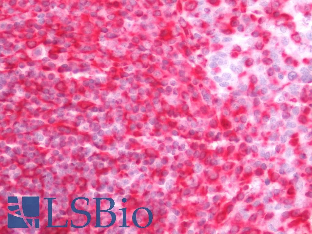 IHC-plus™ Vimentin Antibody (clone 2A52)