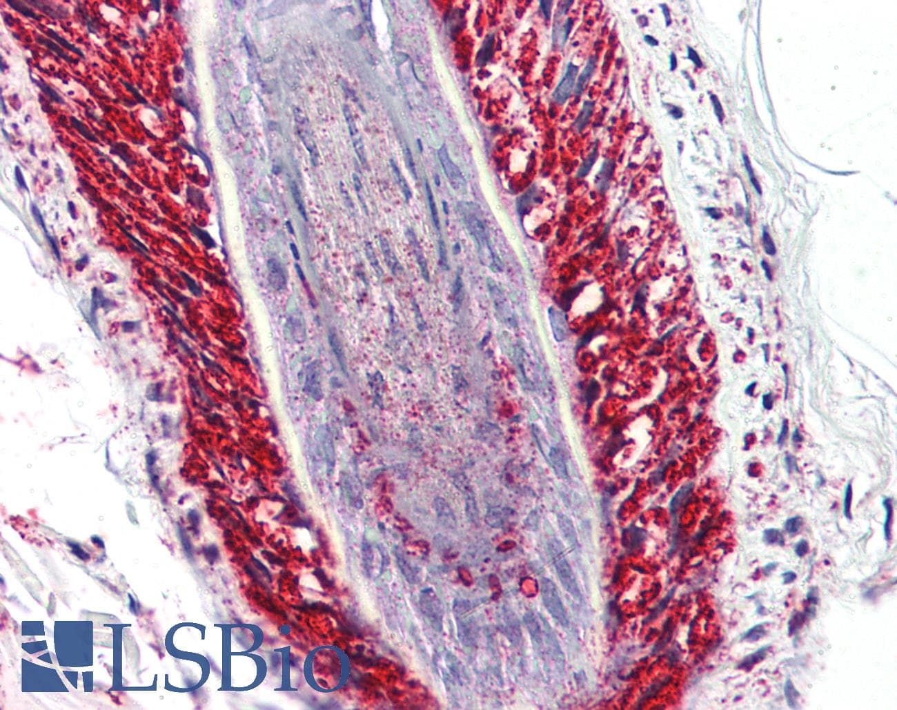 PathPlus™ PKD3 / PRKD3 Antibody (Internal)