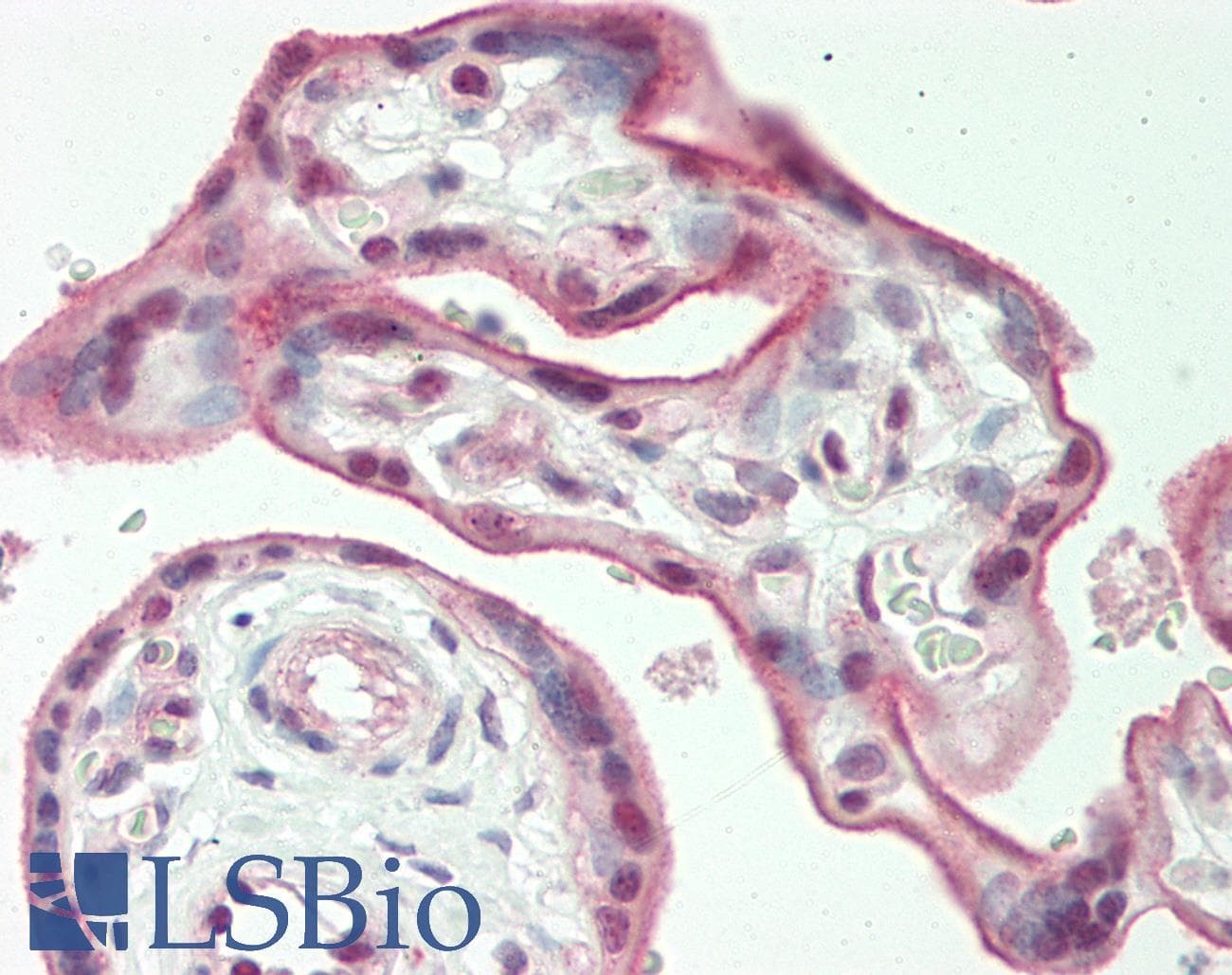 IHC-plus™ Polyclonal Rabbit anti-Human ITGAV/Integrin Alpha V/CD51 Antibody (IHC, WB)