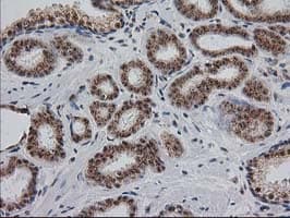 Monoclonal Mouse anti-Human MGLL / Monoacylglycerol Lipase Antibody (clone OTI1H1, IHC, IF, WB)