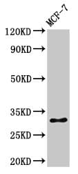 Polyclonal Rabbit anti-Human HIST1H1B Antibody (phospho-Ser17, WB)