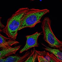 IHC-plus™ PDK1 Antibody (clone 4A11)