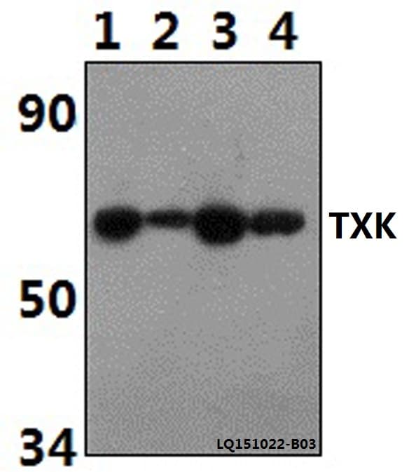 TXK / RLK Antibody