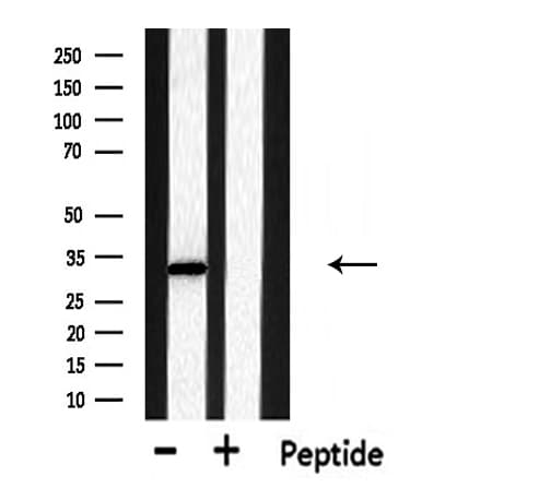 Polyclonal Rabbit anti-Human DHRS4 / PSCD Antibody (IHC, IF, WB)