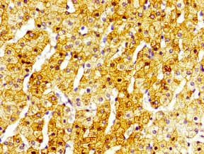 Polyclonal Rabbit anti-Human SIRT5 / Sirtuin 5 Antibody (IHC, IF)
