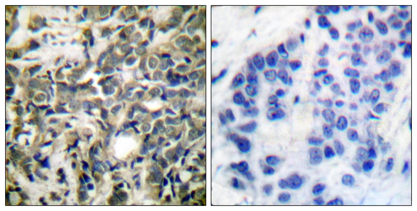 Polyclonal Rabbit anti-Human YWHAZ / 14-3-3 Zeta Antibody (phospho-Ser58, IHC, IF, WB)
