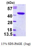 Human PBK / TOPK Protein (Recombinant His)