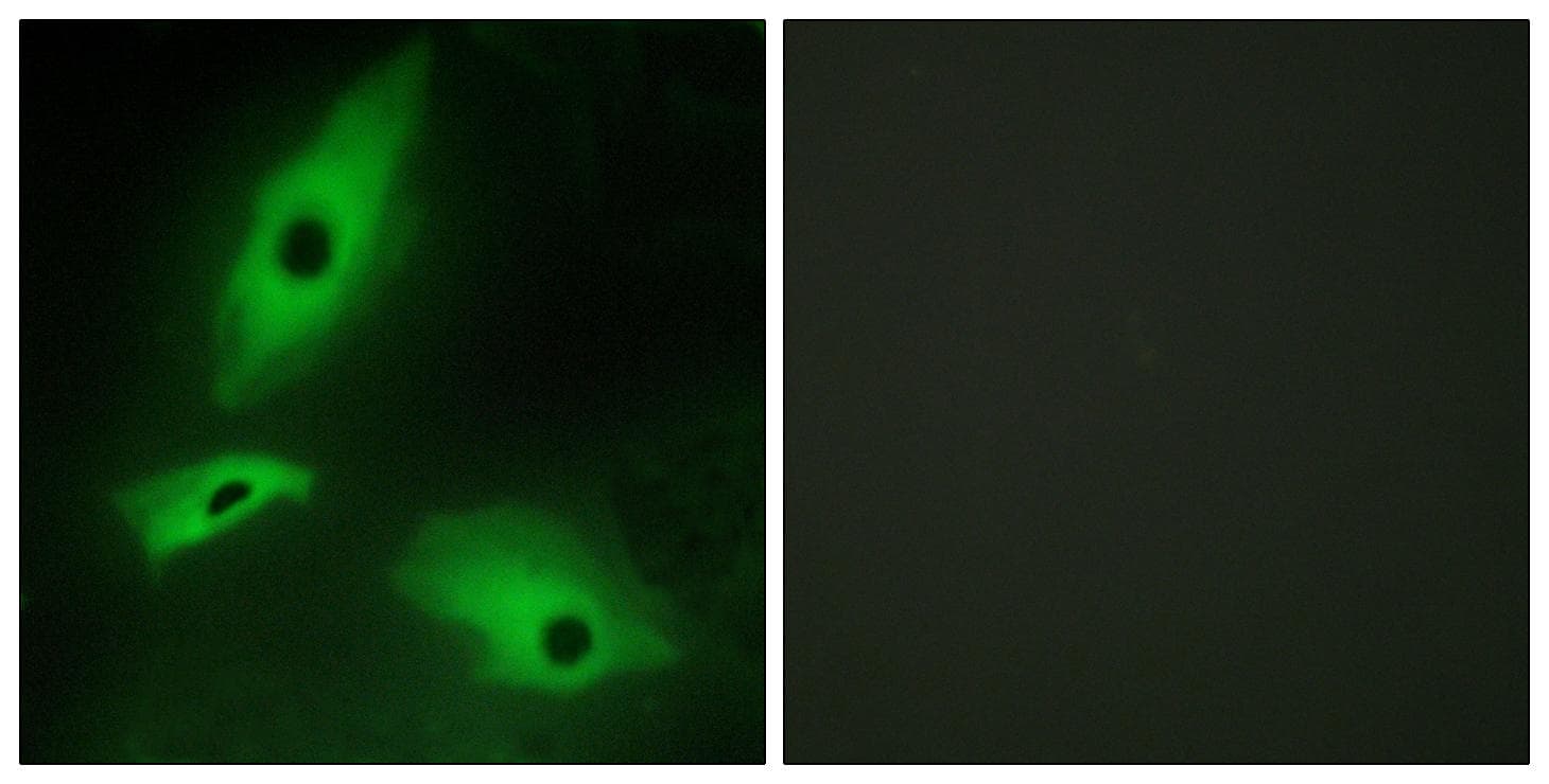 LTBR Antibody