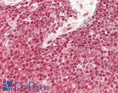 KLRK1 / CD314 / NKG2D Antibody (C-Terminus)