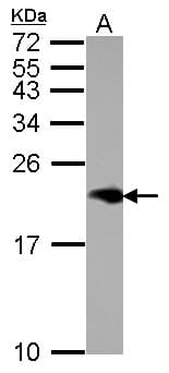 Polyclonal Rabbit anti-Human NPC2 Antibody (IHC, WB)