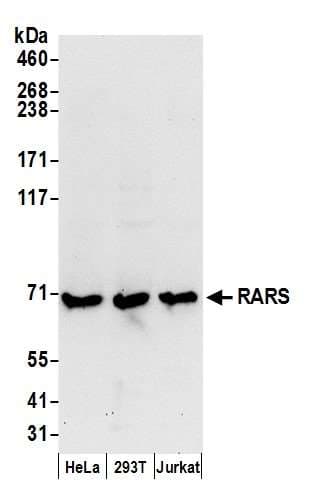 RARS Antibody (aa1-50)