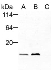 Polyclonal Rabbit anti-Human FIS1 Antibody (WB)