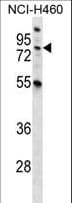 Polyclonal Rabbit anti-Human MST1 Antibody (aa454-483, IHC, WB)