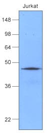 Monoclonal Mouse anti-Human HSP40 Antibody (clone K1C7, aa1-340, WB)
