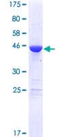 Human MED18 Protein (Recombinant GST)