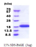 Human DPY30 Protein (Recombinant His)