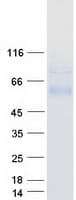 Human SPAM1 / PH20 Protein (Recombinant Myc-DDK (Flag))