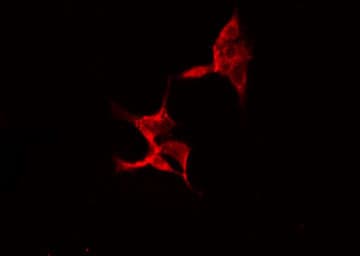 TP53 / p53 Antibody