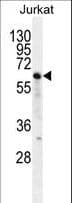 Polyclonal Rabbit anti-Human NKD2 Antibody (aa366-393, IHC, IF, WB)