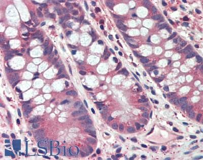 Polyclonal Rabbit anti-Rat Fgf15 Antibody (aa25-218, IHC, WB)
