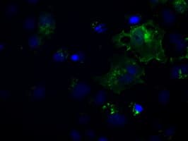 L1CAM Antibody (clone OTI1H3)