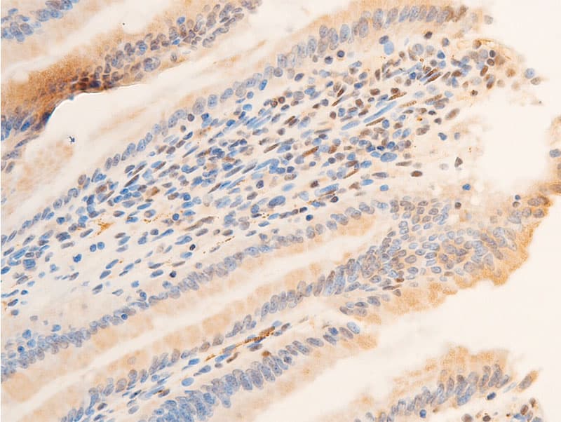 SGK1 / SGK Antibody (phospho-Ser422)