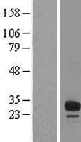 Human FAM125B Protein (Over-Expression Lysate Myc-DDK (Flag))