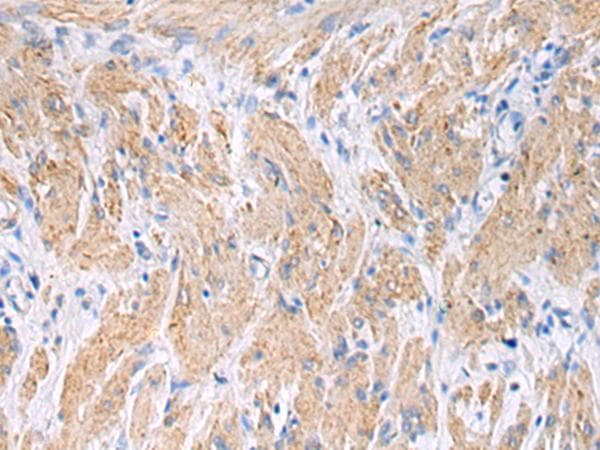 FBXO45 Antibody