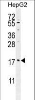 MRFAP1L1 Antibody (aa28-56)