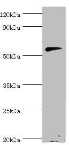 Polyclonal Rabbit anti-Human CNDP1 Antibody (aa1-280, WB)