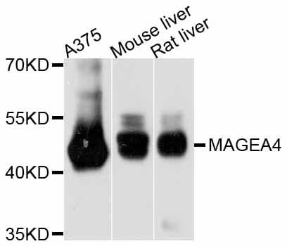 MAGEA4 Antibody