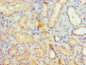 ESET / SETDB1 Antibody (aa1-397)