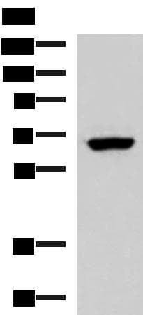 PPP2R1A Antibody
