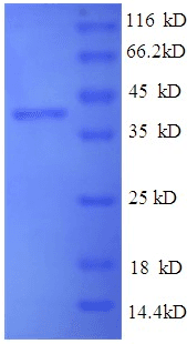 Human SEPP1 / Selenoprotein P (Recombinant 6His, N-terminus)