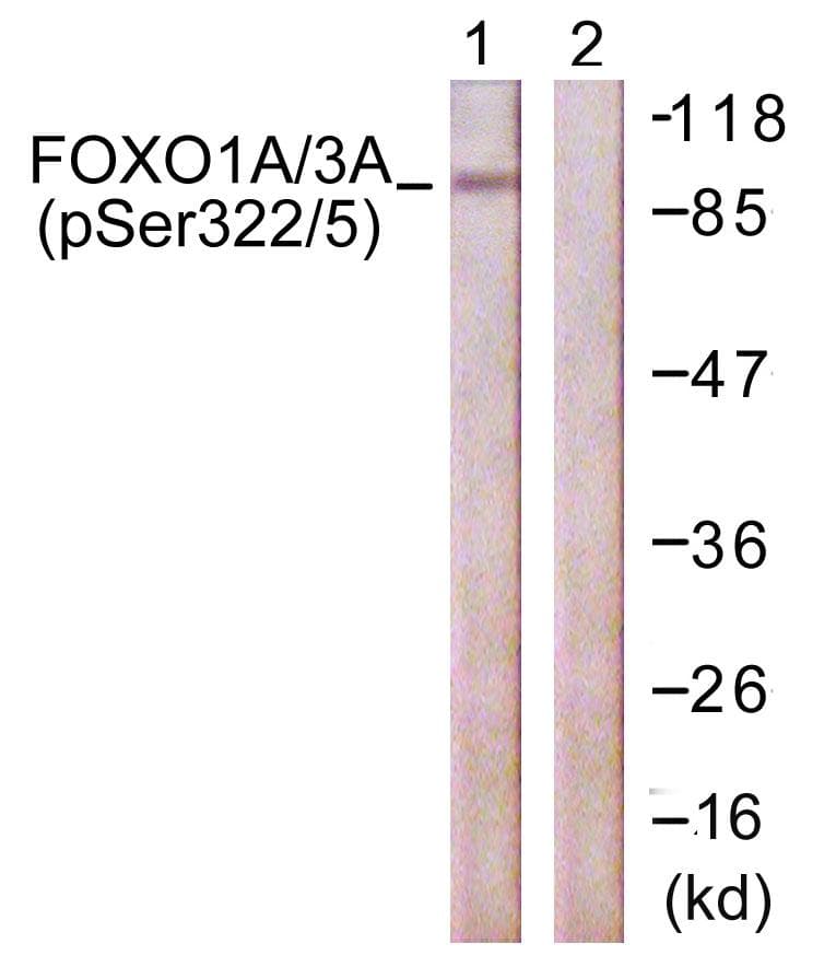 FOXO1 / FKHR Antibody (phospho-Ser322+Ser325)