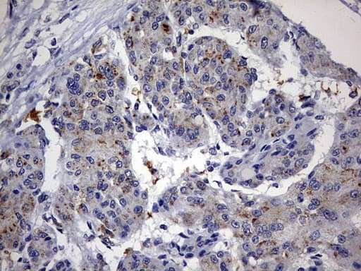Monoclonal Mouse anti-Human ALDP / ABCD1 Antibody (clone OTI2C12, aa508-745, IHC, WB)