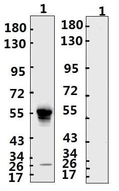 SARS-CoV-2 Nucleoprotein Antibody