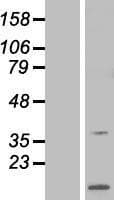 RCS / ARPP-21 Protein (Over-Expression Lysate Myc-DDK (Flag))