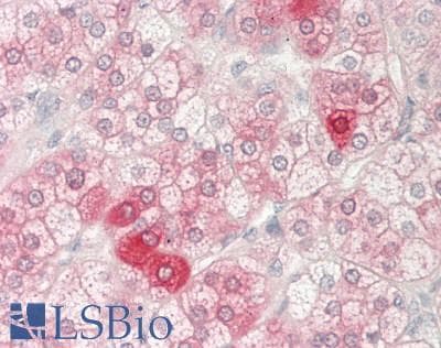 KAT5 / TIP60 Antibody (aa395-444)