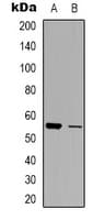 IHC-plus™ SLC30A1 / ZNT1 Antibody (Internal)