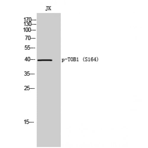 TOB1 / TOB Antibody (100-180 aa)